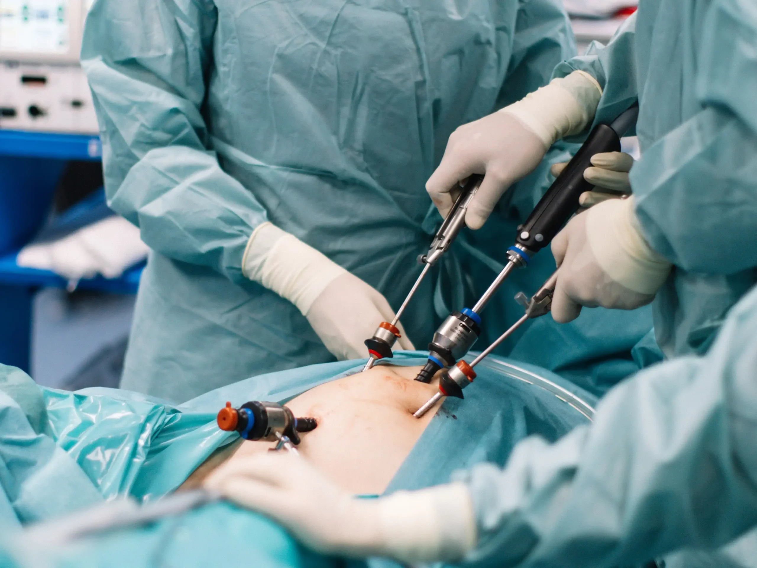 Centar za laparoskopsku ginekolosku hirurgiju i endometriozu